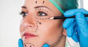 Plastic Surgery on a Budget? Discover Financing Plans That Work!