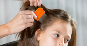 Lice Removal Methods